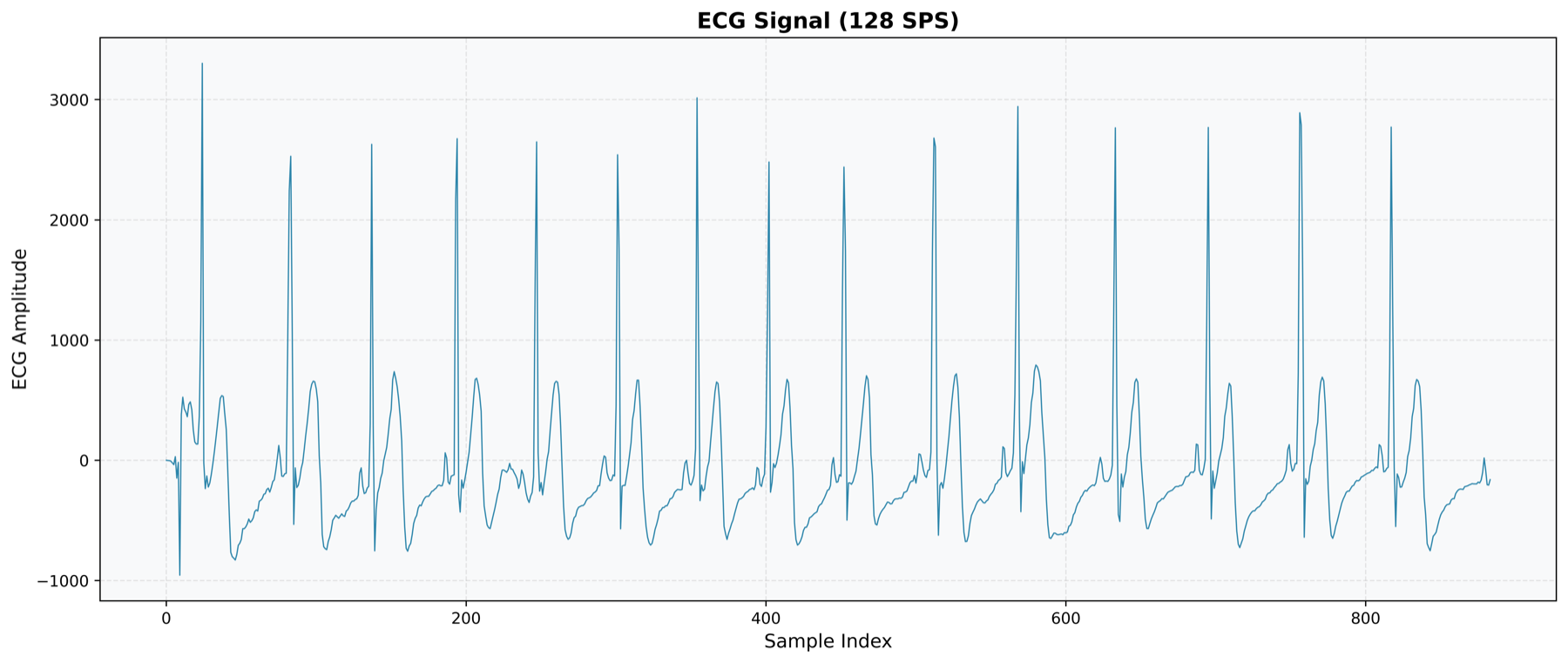 ECG signal recorded at 128 samples per second, with regular R peaks